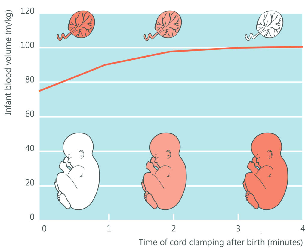 Optimal Cord Clamping - Precious Arrows Doula Services