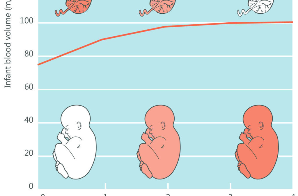 Optimal Cord Clamping